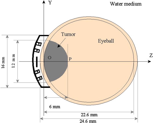 COMS Plaque on Eye